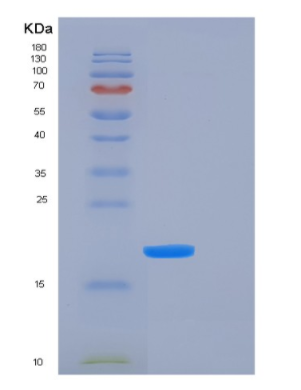 Recombinant Human FTL Protein,Recombinant Human FTL Protein