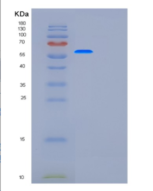 Recombinant Human G6PD Protein,Recombinant Human G6PD Protein