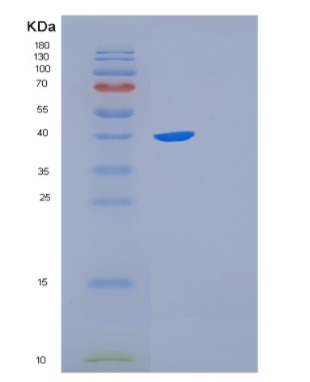 Recombinant Human FKBPL Protein,Recombinant Human FKBPL Protein