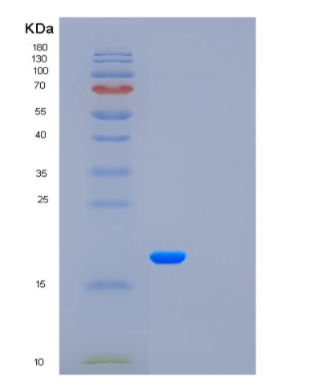 Recombinant Colony Stimulating Factor 3, Granulocyte (GCSF),Recombinant Colony Stimulating Factor 3, Granulocyte (GCSF)