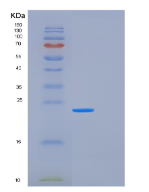 Recombinant Human FTSJ2 Protein,Recombinant Human FTSJ2 Protein