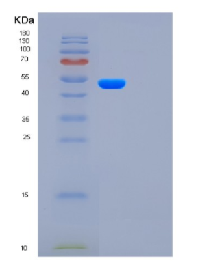 Recombinant Human FUCA2 Protein,Recombinant Human FUCA2 Protein