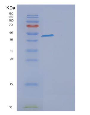 Recombinant Human G3BP2 Protein,Recombinant Human G3BP2 Protein