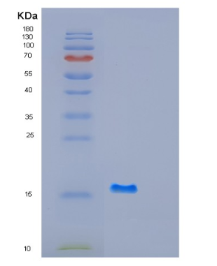 Recombinant Human GABARAPL1 Protein,Recombinant Human GABARAPL1 Protein