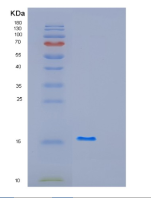 Recombinant Human GABARAPL2 Protein,Recombinant Human GABARAPL2 Protein