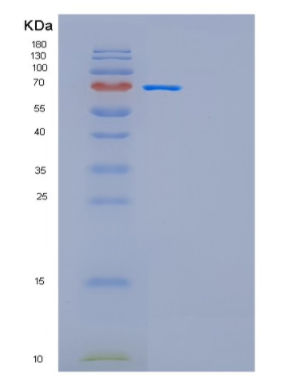 Recombinant Human GAD1-iso1 Protein,Recombinant Human GAD1-iso1 Protein