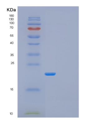 Recombinant Human GADD45GIP1 Protein,Recombinant Human GADD45GIP1 Protein