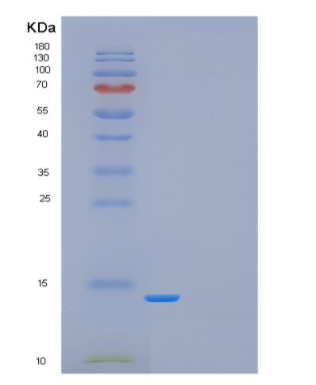 Recombinant Human Drosophila melanogaster GAGA-POZ domain Protein,Recombinant Human Drosophila melanogaster GAGA-POZ domain Protein