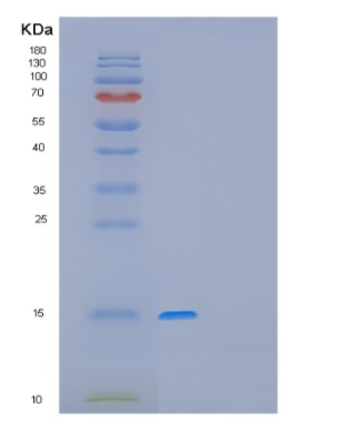 Recombinant Human GAGE12F Protein,Recombinant Human GAGE12F Protein