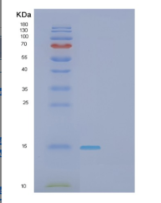 Recombinant Human GAGE2A Protein,Recombinant Human GAGE2A Protein