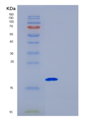 Recombinant Human Galectin9 Protein,Recombinant Human Galectin9 Protein