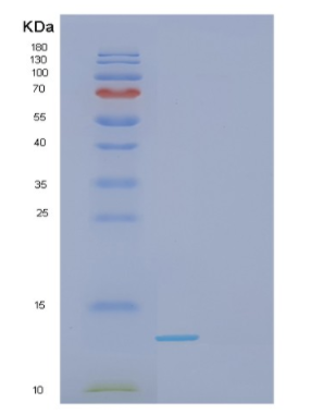 Recombinant Human GAL Protein,Recombinant Human GAL Protein