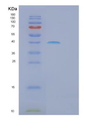 Recombinant Human GALE Protein,Recombinant Human GALE Protein