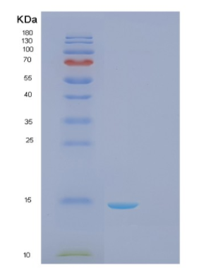 Recombinant Human Galectin-1 Protein,Recombinant Human Galectin-1 Protein