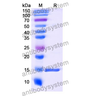 抗 Human GAK 納米抗體 (SAA1190)(RHA36701),Anti-Human GAK Nanobody (SAA1190)