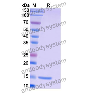 抗 Human CD156a/ADAM8 纳米抗体 (SAA1215)(RHF64101),Anti-Human CD156a/ADAM8 Nanobody (SAA1215)