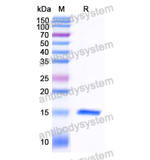 抗 Human IGHE 纳米抗体 (SAA1191)(RHJ92704),Anti-Human IGHE Nanobody (SAA1191)