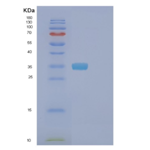 Recombinant Human FDFT1 Protein