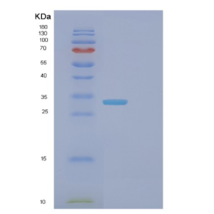 Recombinant Mouse Fcgrt Protein