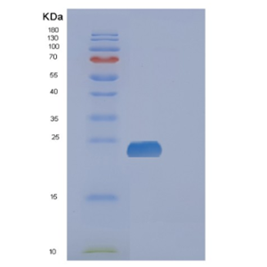 Recombinant Human FAM3C Protein,Recombinant Human FAM3C Protein
