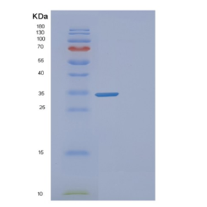 Recombinant Human FAM84A Protein