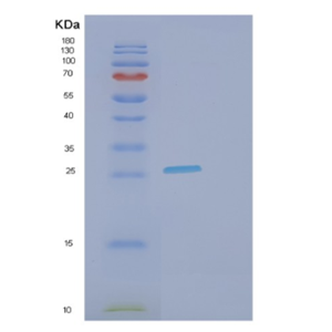 Recombinant Human FCGR3A Protein