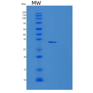 Recombinant Human FHL3 Protein