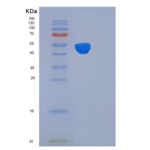 Recombinant Human FKBP4 Protein,Recombinant Human FKBP4 Protein