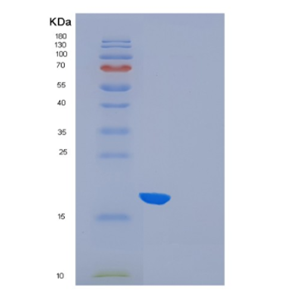 Recombinant Human Fms-related tyrosine kinase 3 ligand Protein