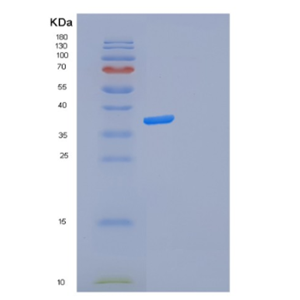 Recombinant Human FOSL2 Protein,Recombinant Human FOSL2 Protein