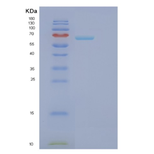 Recombinant Human FARSB Protein