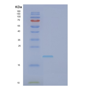 Recombinant Human FASLG Protein,Recombinant Human FASLG Protein