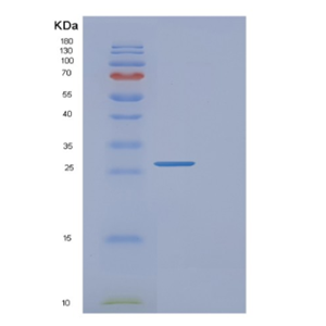 Recombinant Human FAIM Protein