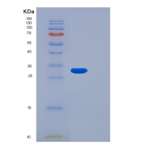 Recombinant Human FGF14 Protein,Recombinant Human FGF14 Protein