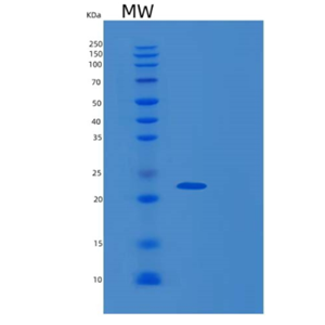 Recombinant Human FGFR1OP Protein,Recombinant Human FGFR1OP Protein