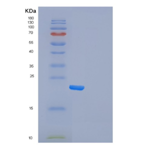 Recombinant Human Frataxin Protein,Recombinant Human Frataxin Protein