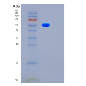 Recombinant Human FSCN1 Protein,Recombinant Human FSCN1 Protein