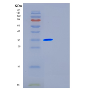 Recombinant Human FSTL1 Protein,Recombinant Human FSTL1 Protein