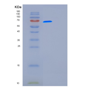 Recombinant Human Furin Protein,Recombinant Human Furin Protein