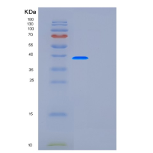 Recombinant Human FUT7 Protein