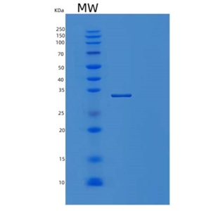 Recombinant Human FHL2 Protein,Recombinant Human FHL2 Protein
