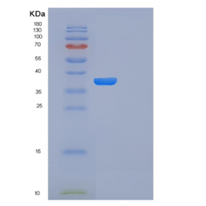 Recombinant Human FN3K Protein