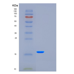 Recombinant Human FXYD5 Protein,Recombinant Human FXYD5 Protein