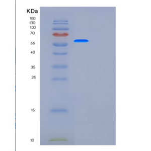 Recombinant Human G6PD Protein
