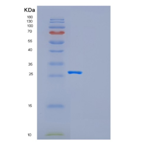 Recombinant Human GAD1 Protein