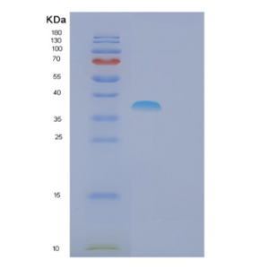 Recombinant Human FSBP Protein