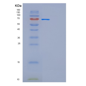 Recombinant Human GAD1-iso1 Protein,Recombinant Human GAD1-iso1 Protein