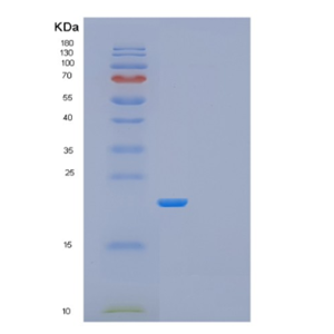 Recombinant Human GADD45GIP1 Protein,Recombinant Human GADD45GIP1 Protein