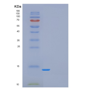 Recombinant Human Drosophila melanogaster GAGA-POZ domain Protein,Recombinant Human Drosophila melanogaster GAGA-POZ domain Protein