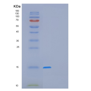 Recombinant Human GAGE12F Protein,Recombinant Human GAGE12F Protein